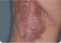 Image of knee at week 8