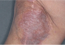 Image of knee at week 4