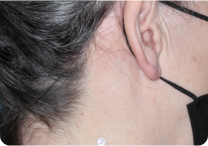 Image of neck at week 8