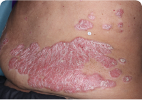 Image of torso at day 0