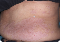 Image of torso at week 8