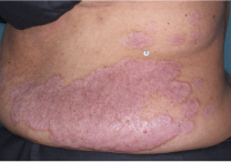 Image of torso at week 4