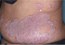 Image of torso at week 2